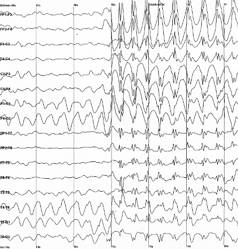 eeg_example